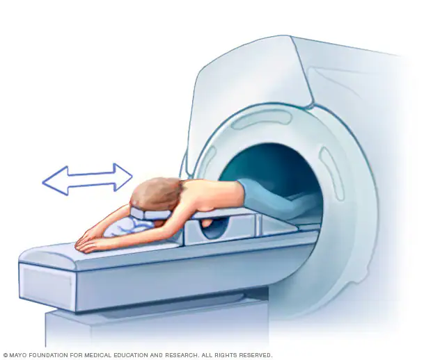 Breast MRI screening procedure
